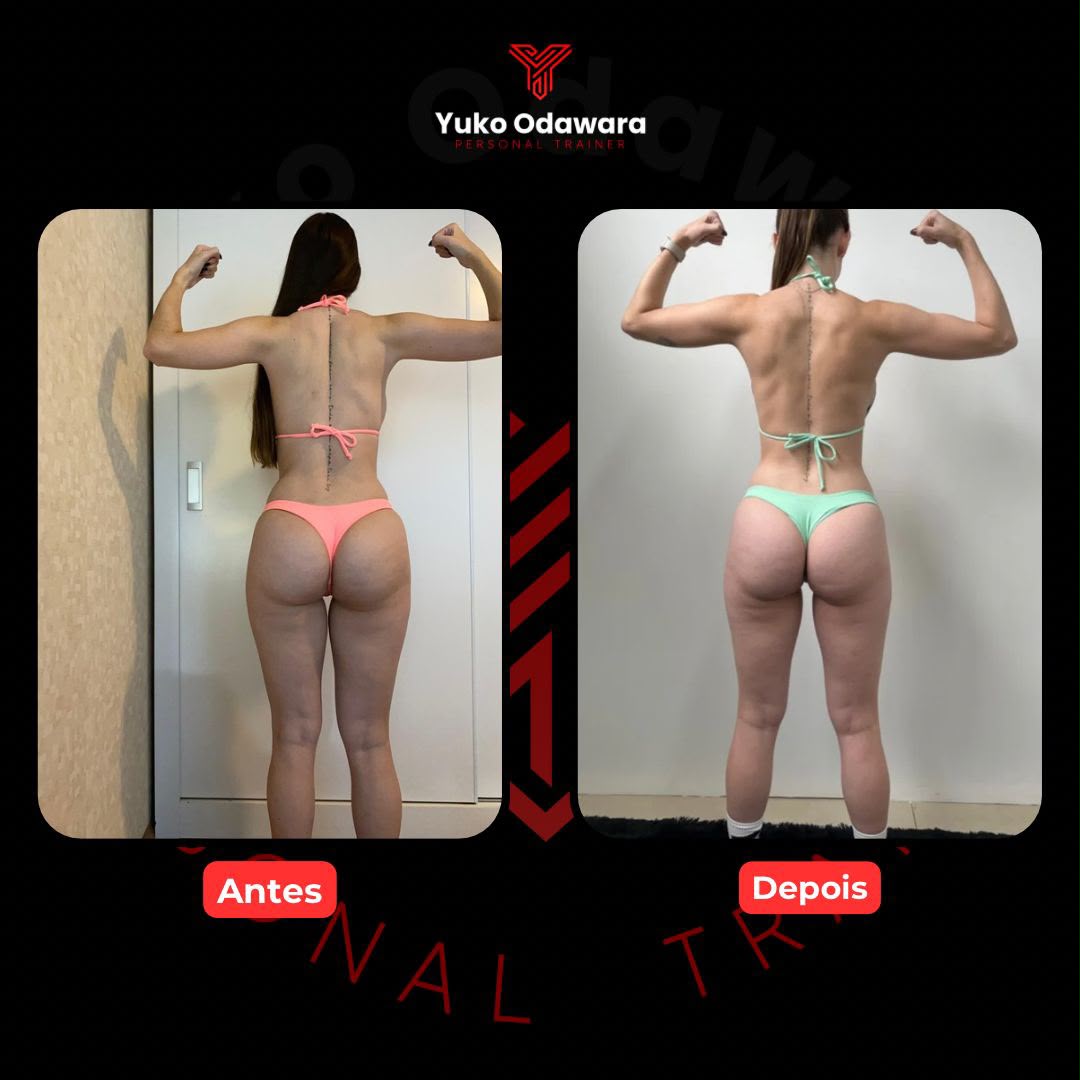 Evolução real de aluna, vista posterior